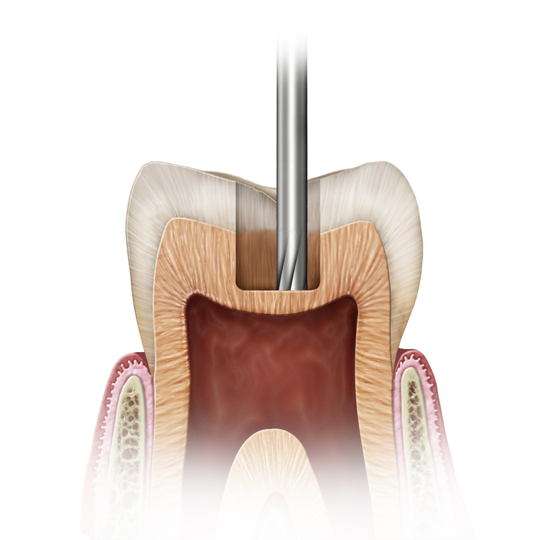 FG CARBIDE 956 - Image 2